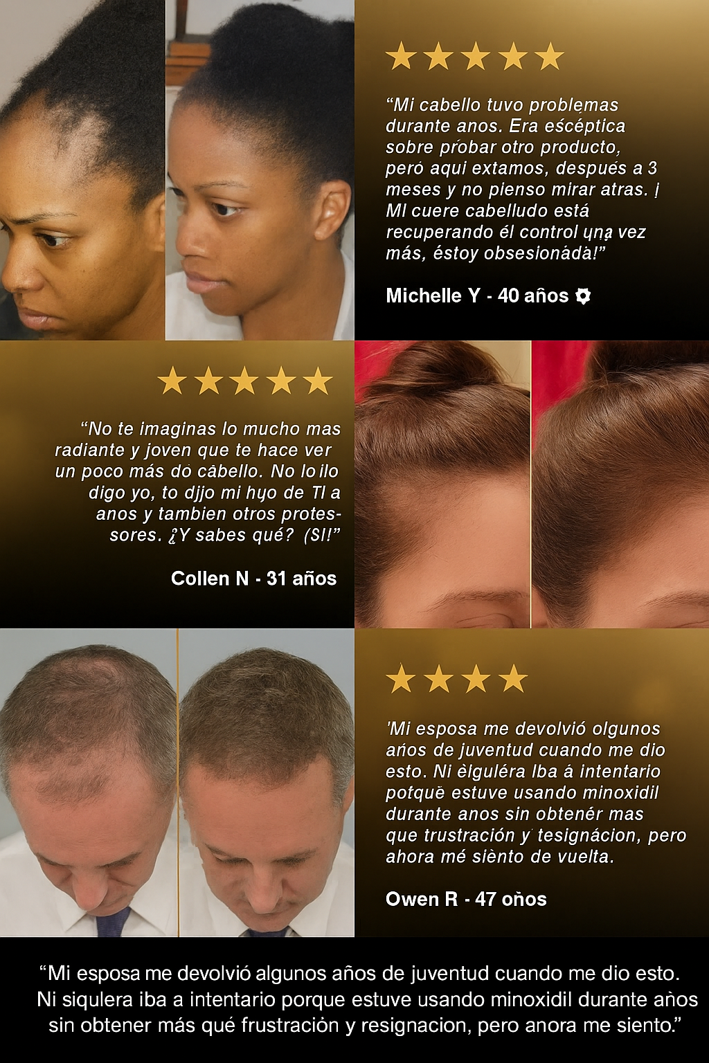 Aceite Valeva - El tratamiento diario que blinda tu cabello contra el quiebre y la caída