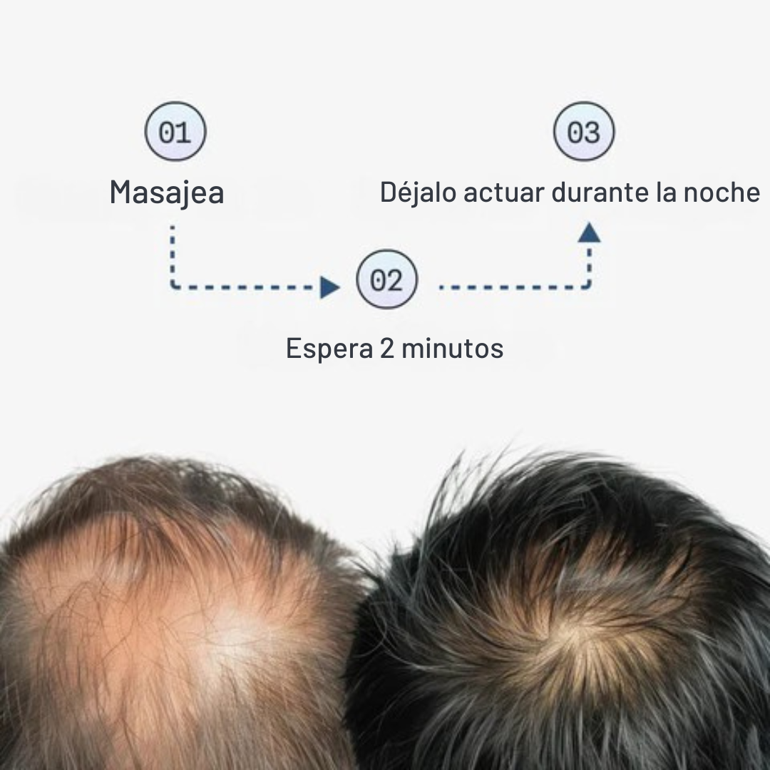 Tratamiento Intensivo de Crecimiento Capilar con Péptidos de Cobre